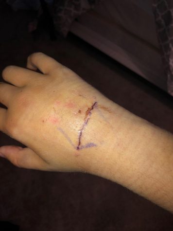 Cate Thomas overcomes hand injury